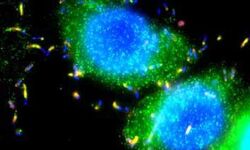 Prof. Robert Munford: Bacterial Lipopolysaccharides: Human Disease Determinants? 