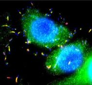 Prof. Robert Munford: Bacterial Lipopolysaccharides: Human Disease Determinants? 